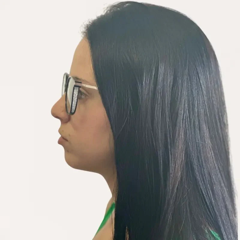 Crystal Elite Vision Multifocal Glasses - Image 3